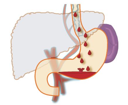 Illustration of drops of blood going into the stomach.